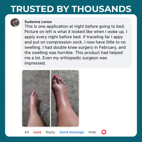 TAYNYOVA Miracle Balm – Herbal Relief for Swollen & Tired Legs